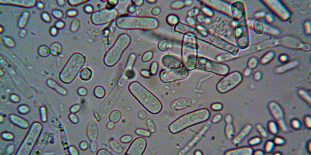 Microorganisms under a microscope. Photo by Turek on Pexels.