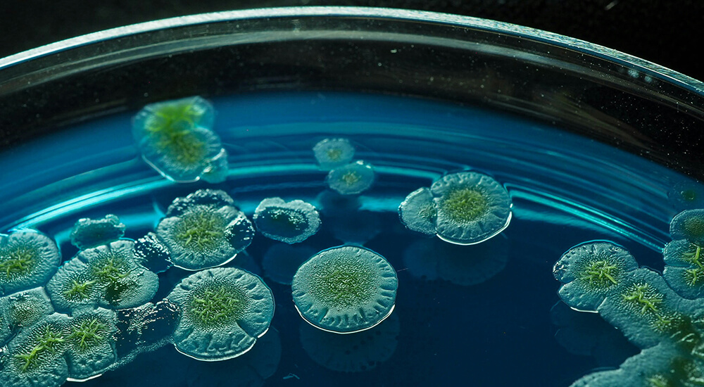Pseudomonas luteola on BTB agar. Photo by Masakazu Sasaki on Unsplash.