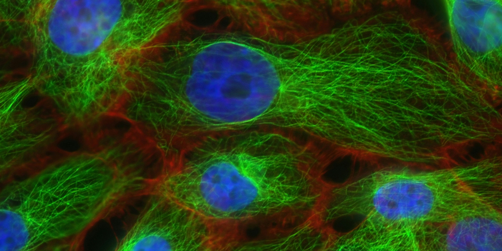 Stress Fibers and Microtubules in Human Breast Cancer Cells. Created by Christina Stuelten, Carole Parent, 2011. Photo by National Cancer Institute on Unsplash.