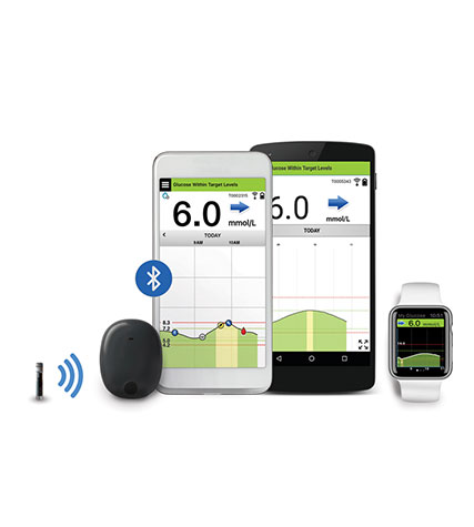 CONTINUOUS GLUCOSE MONITORING SYSTEMS (CGM)